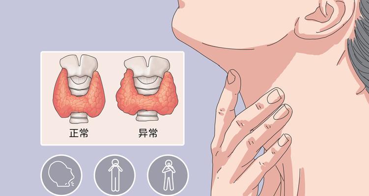 缺碘导致的9种症状及其危害（缺碘对健康的影响及预防措施）