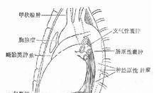 万和热水器故障E9维修方法（感温探头故障的原因及修复指南）